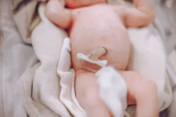 Newborn Belly Button Stages