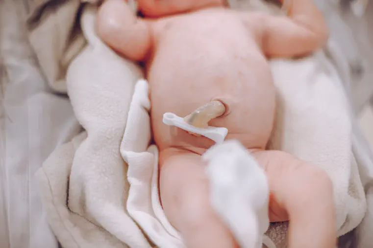 Newborn Belly Button Stages Newborn Belly Button Stages